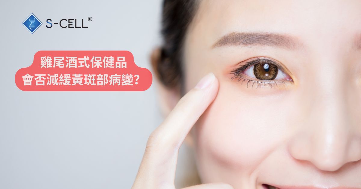 雞尾酒式保健品會否減緩黃斑部病變?